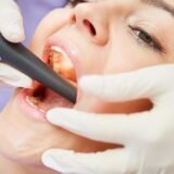 Best Dental clinic in ranchi