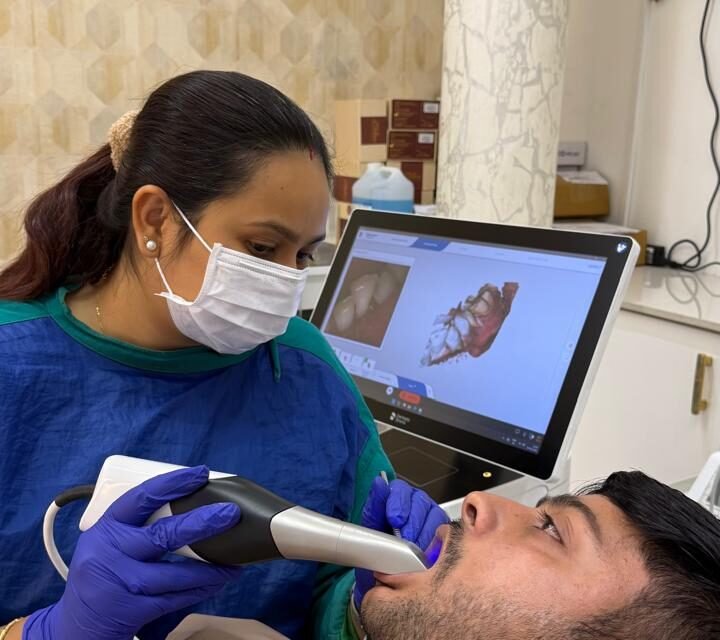 Why Dental Implants Are Becoming the Most Popular Tooth Replacement Option in Ranch
